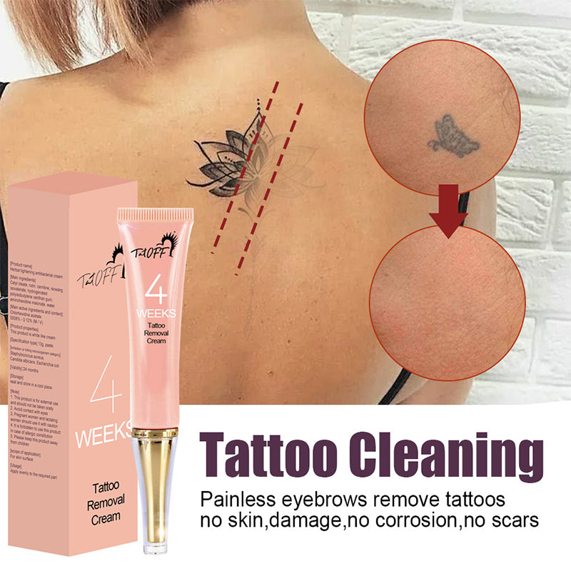 Tattoo Removal Cream
